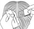 Lice Combing